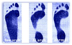 foot types, hi, medium and low arch